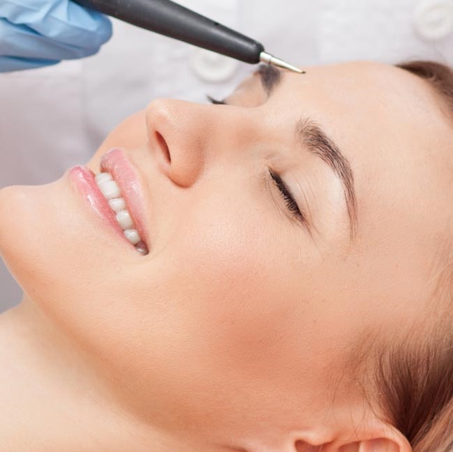 Electrolysis
